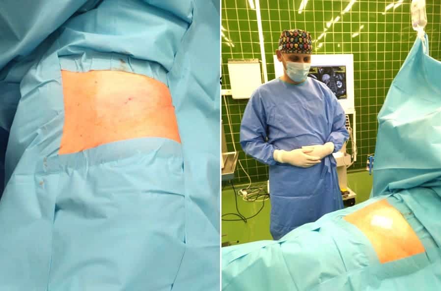 Lekarz w czasie operacji