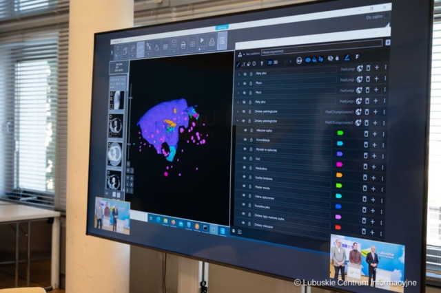 Lubuski projekt wsparcia medycyny systemami sztucznej inteligencji. 11.04.2024